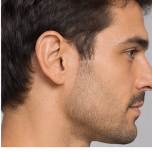 Depilação Masculina de Orelhas